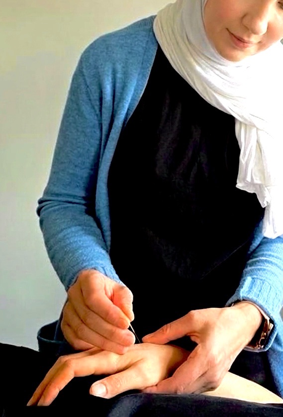 Female practitioner giving acupuncture treatment to a female patient at Vireya Wellness, Marylebone